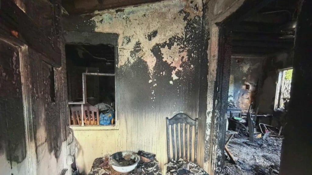 Woman hospitalized after Miami house fire leaves three displaced — CBS Miami, Lubbock Health news